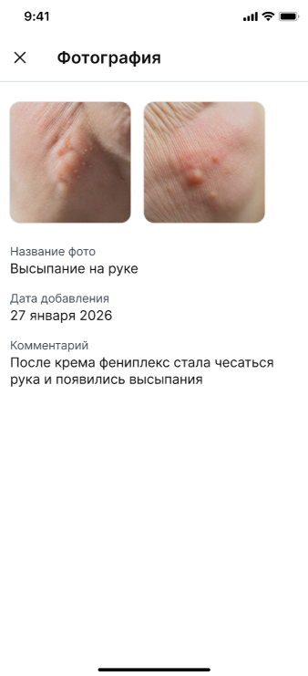 Просмотр фото в чате с пациентом