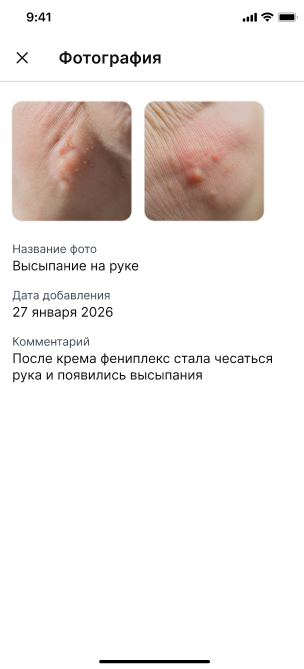 Успех загрузки фото в чат с врачом